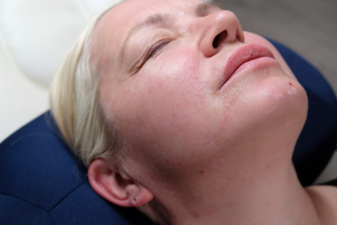 Close-up of calm, healthy facial skin