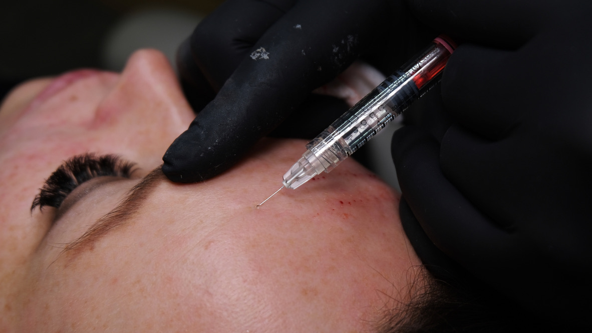 Advanced facial anatomy and injection plane training at Harley Street