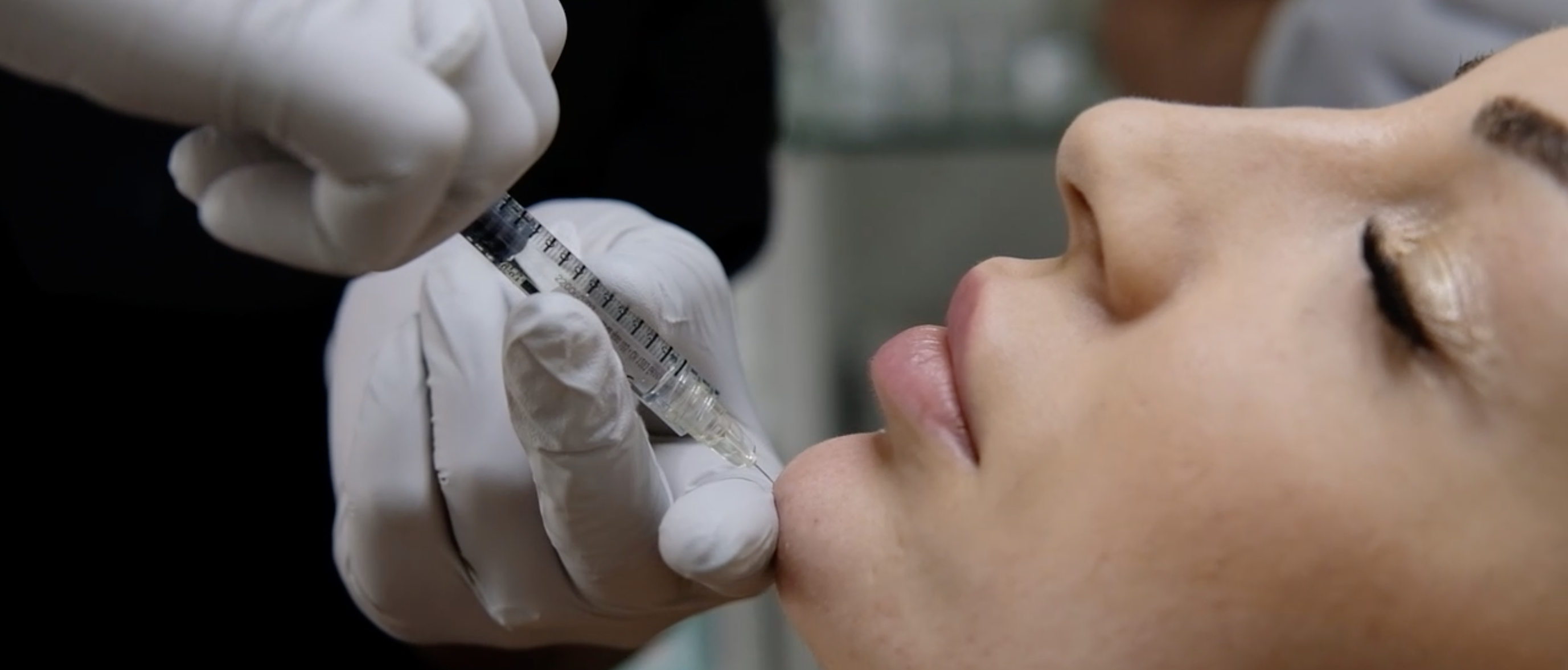 Formation en polynucléotides et Profhilo pour la qualité de la peau - pratique d'injectables sur patient réel