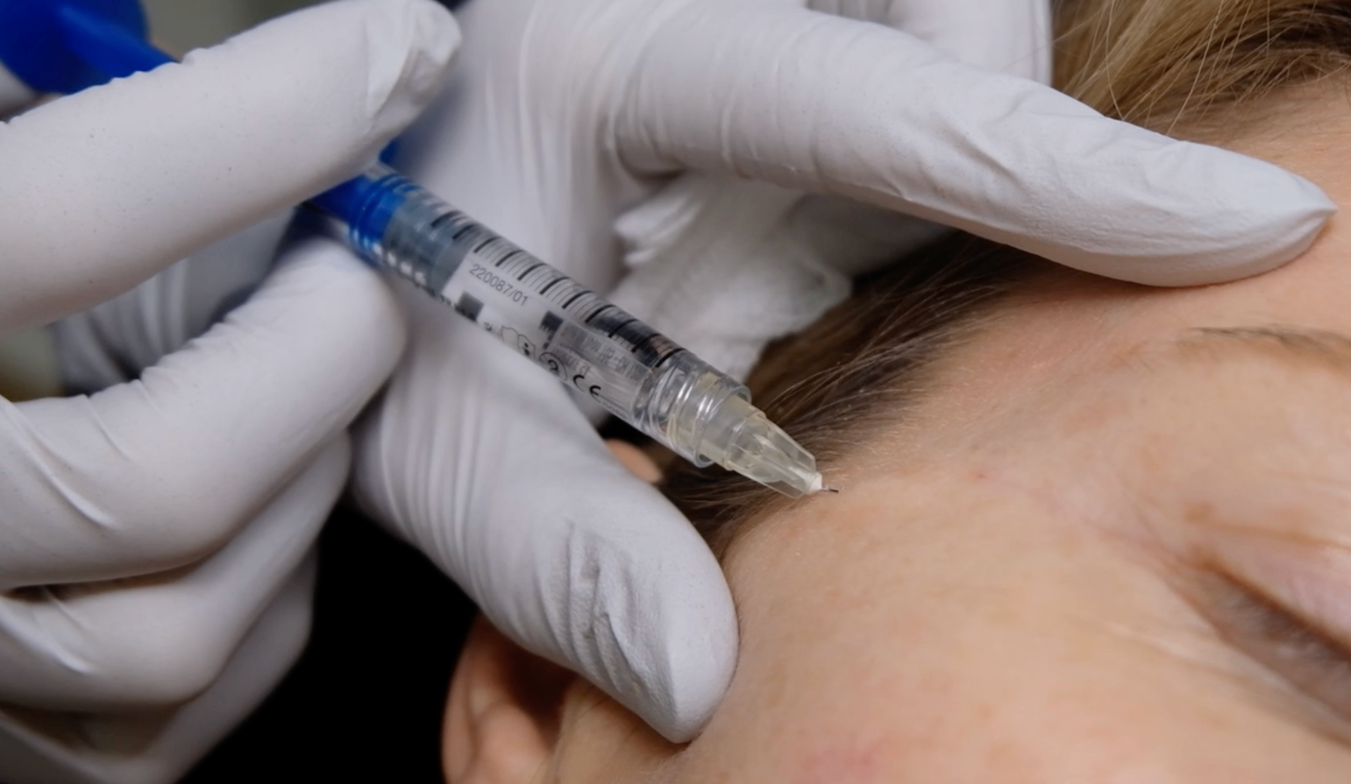 Expert aesthetic injection training technique at temple area showing Dr Haq's teaching methodology for Middle Eastern doctors