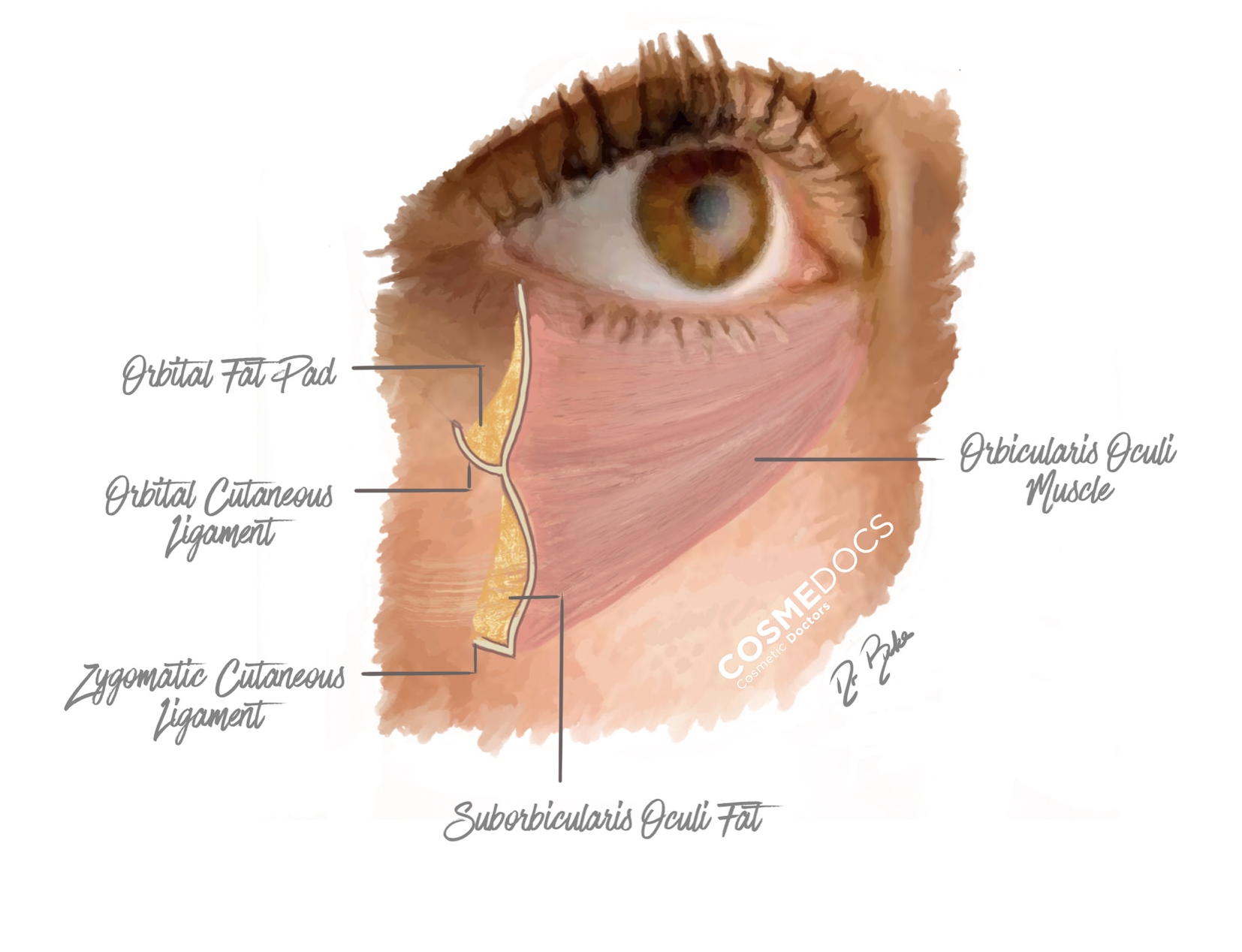 Dr Ahmed Haq tear trough anatomy diagram - orbital fat pad, ligaments, facial anatomy for aesthetic medicine training