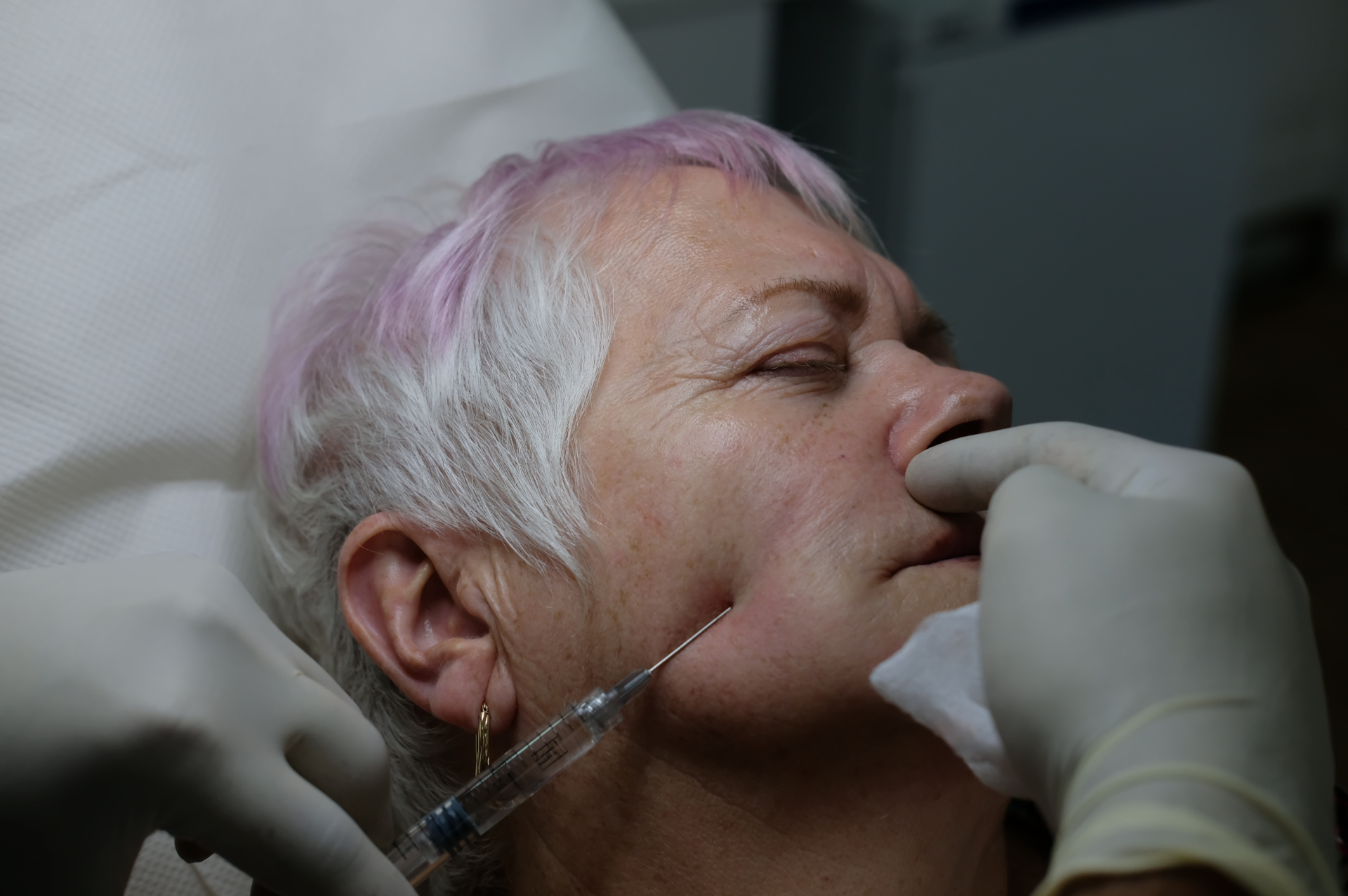 Dr Ahmed Haq aesthetic treatment technique step 1