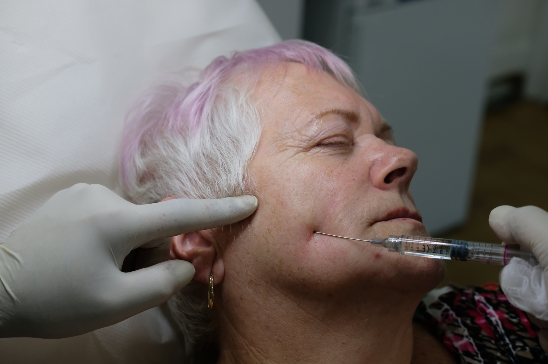 Dr Ahmed Haq aesthetic treatment technique step 4