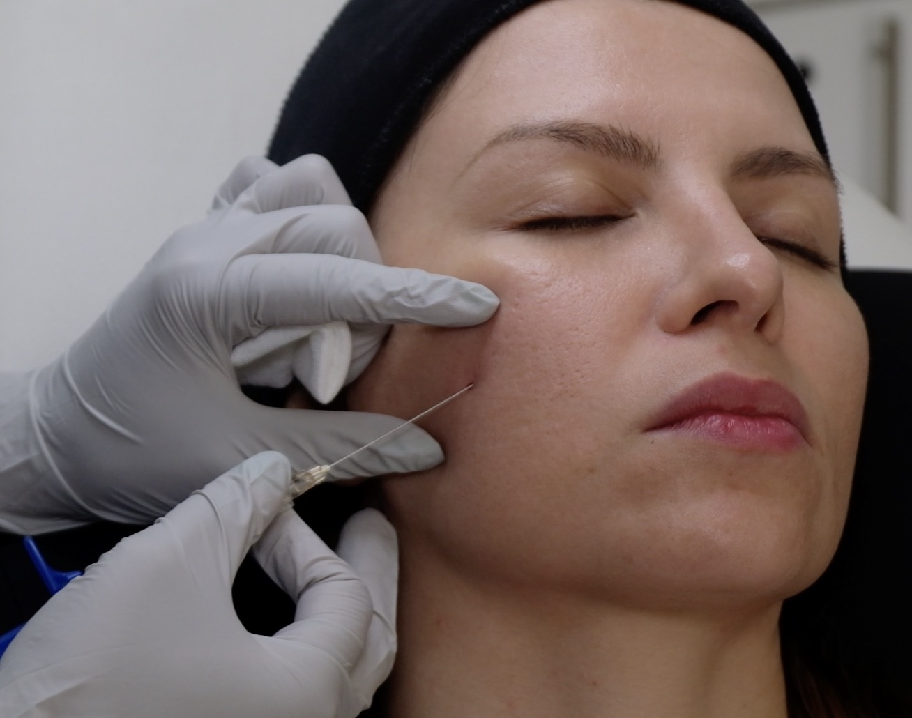 Advanced aesthetic procedure training session at Harley Street Institute