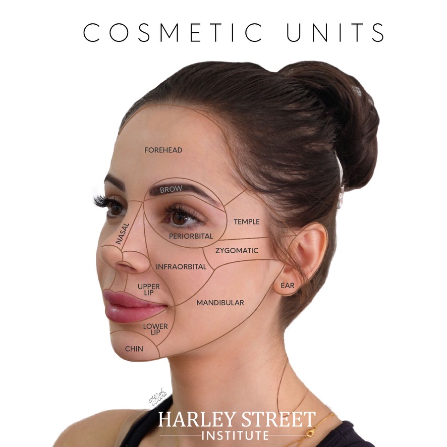 Jawline filler application