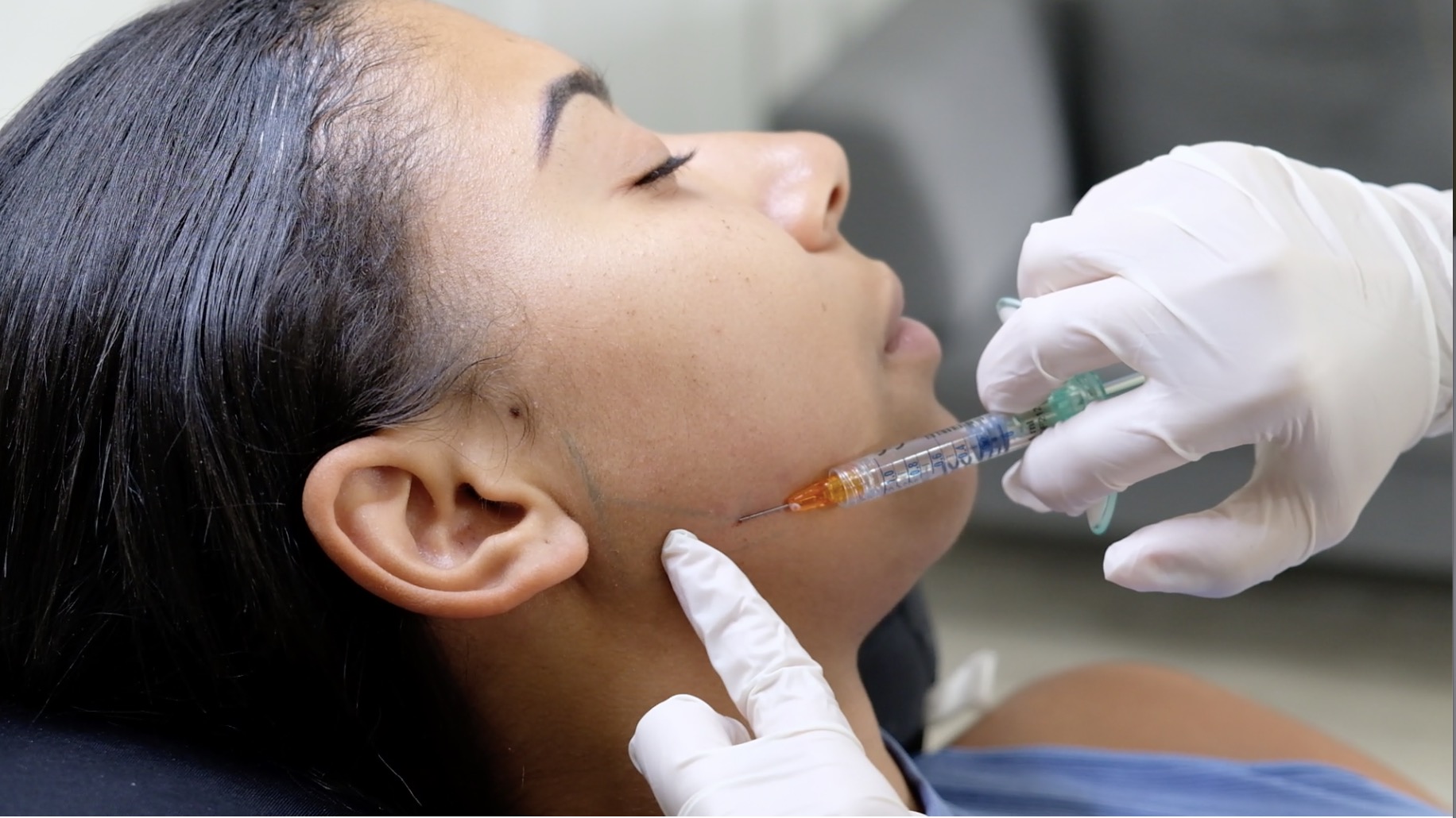 Chin enhancement treatment